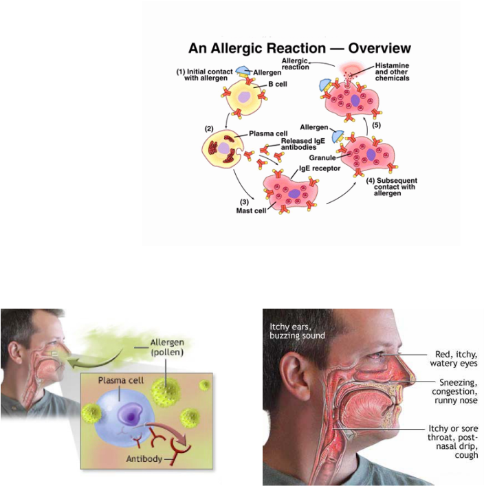 Type I Hypersensitivity Nose Clipart