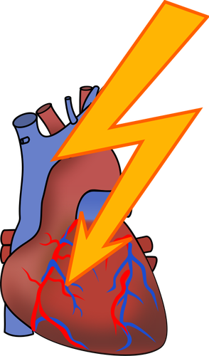 Symbol For Heart Attack Clipart