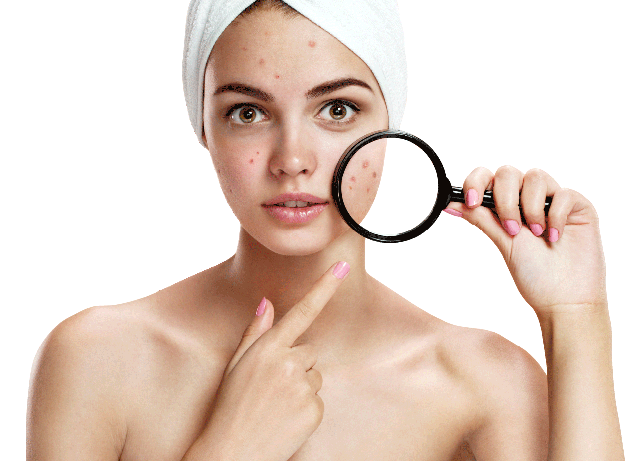 Acne Effect Peroxide Therapy Powder Benzoyl Skin Clipart
